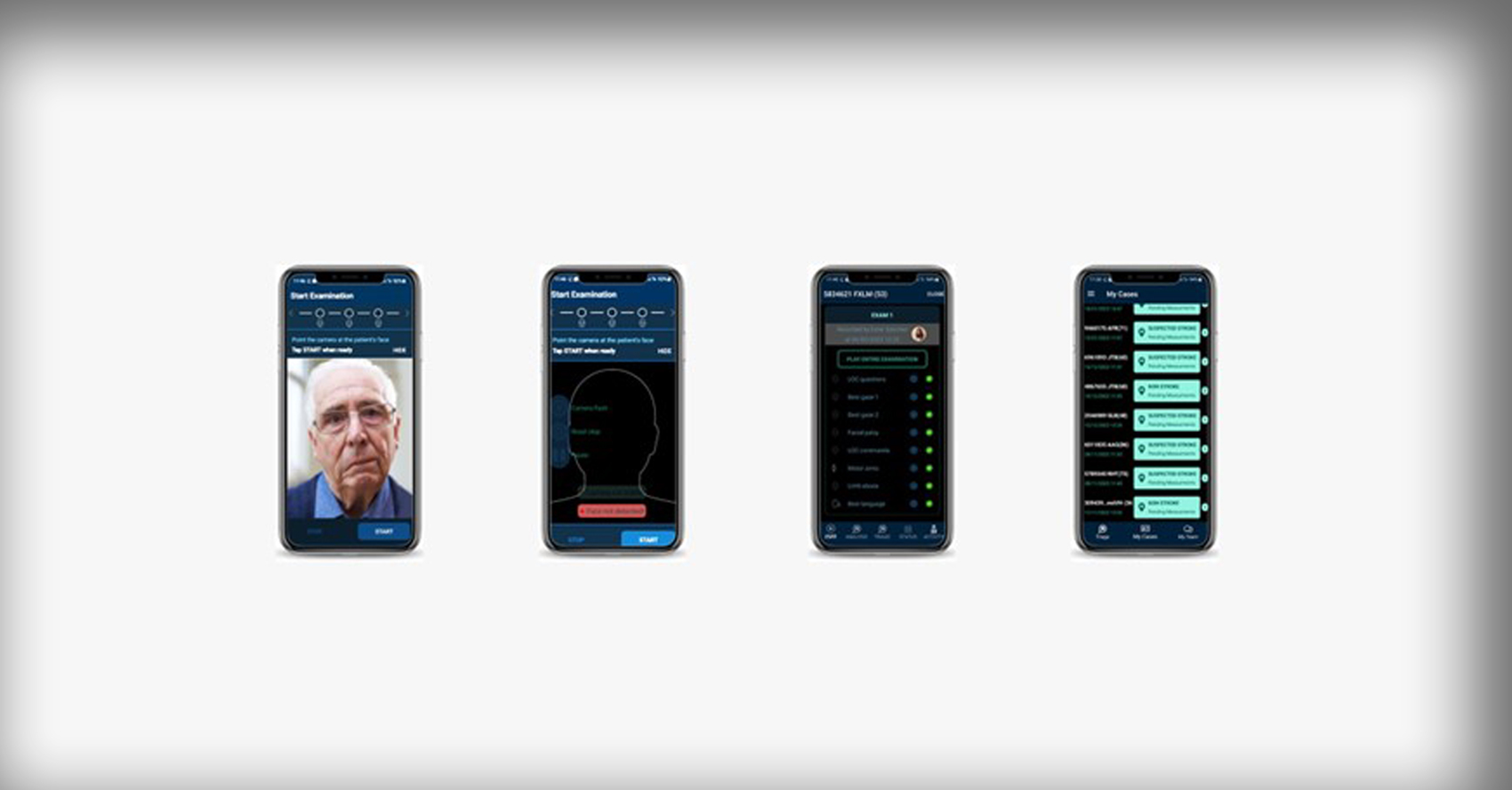 Advocate researchers study smartphone app designed to facilitate stroke diagnosis