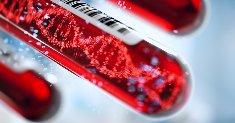 /research/advocate-aurora/research-news/advocate-aurora-health-joins-study-of-investigational-treatment-for-recurrent-c-diff