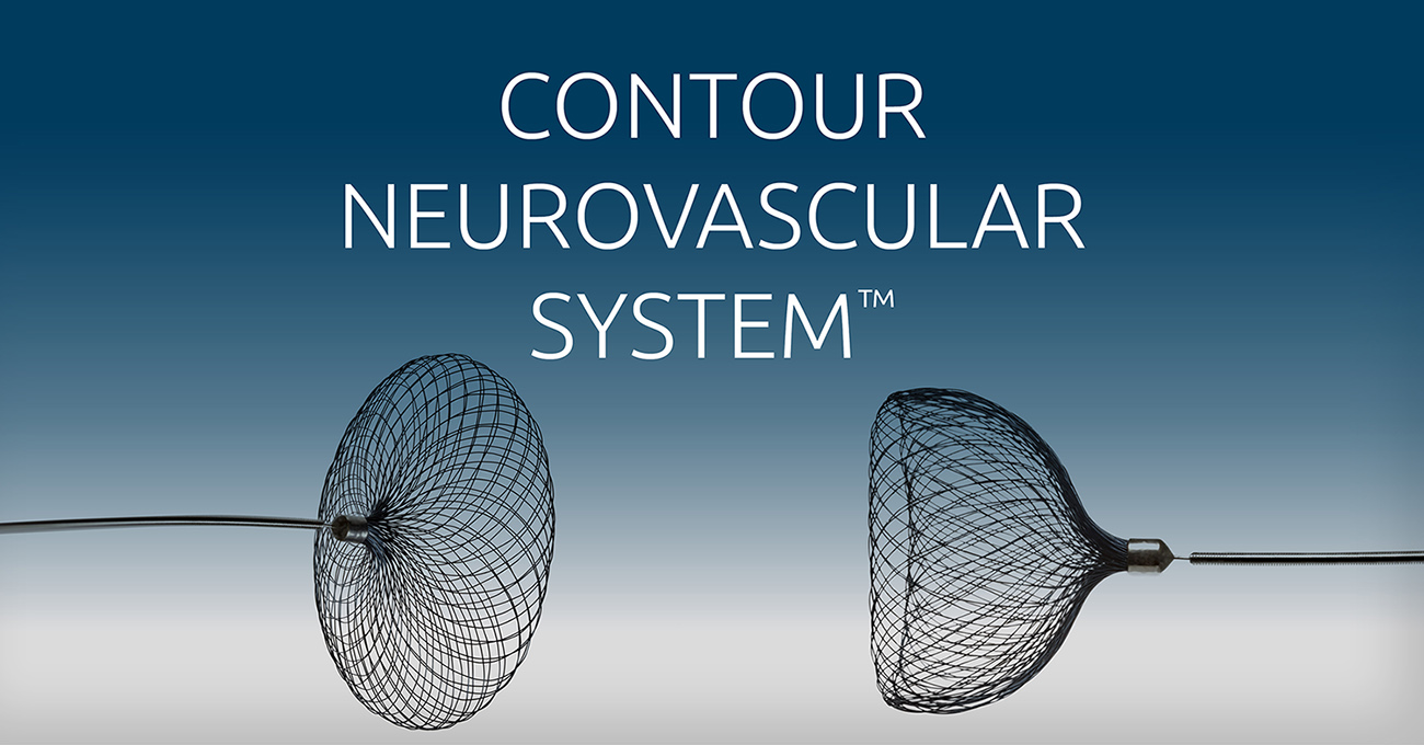 Advocate Aurora Health is first in Midwest to join brain aneurysm clinical trial