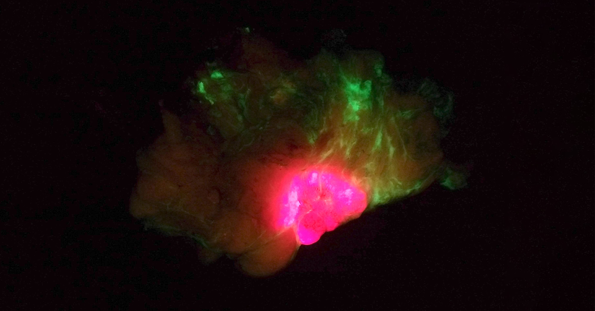 Research Institute joins study of fluorescence imaging during breast conserving surgery