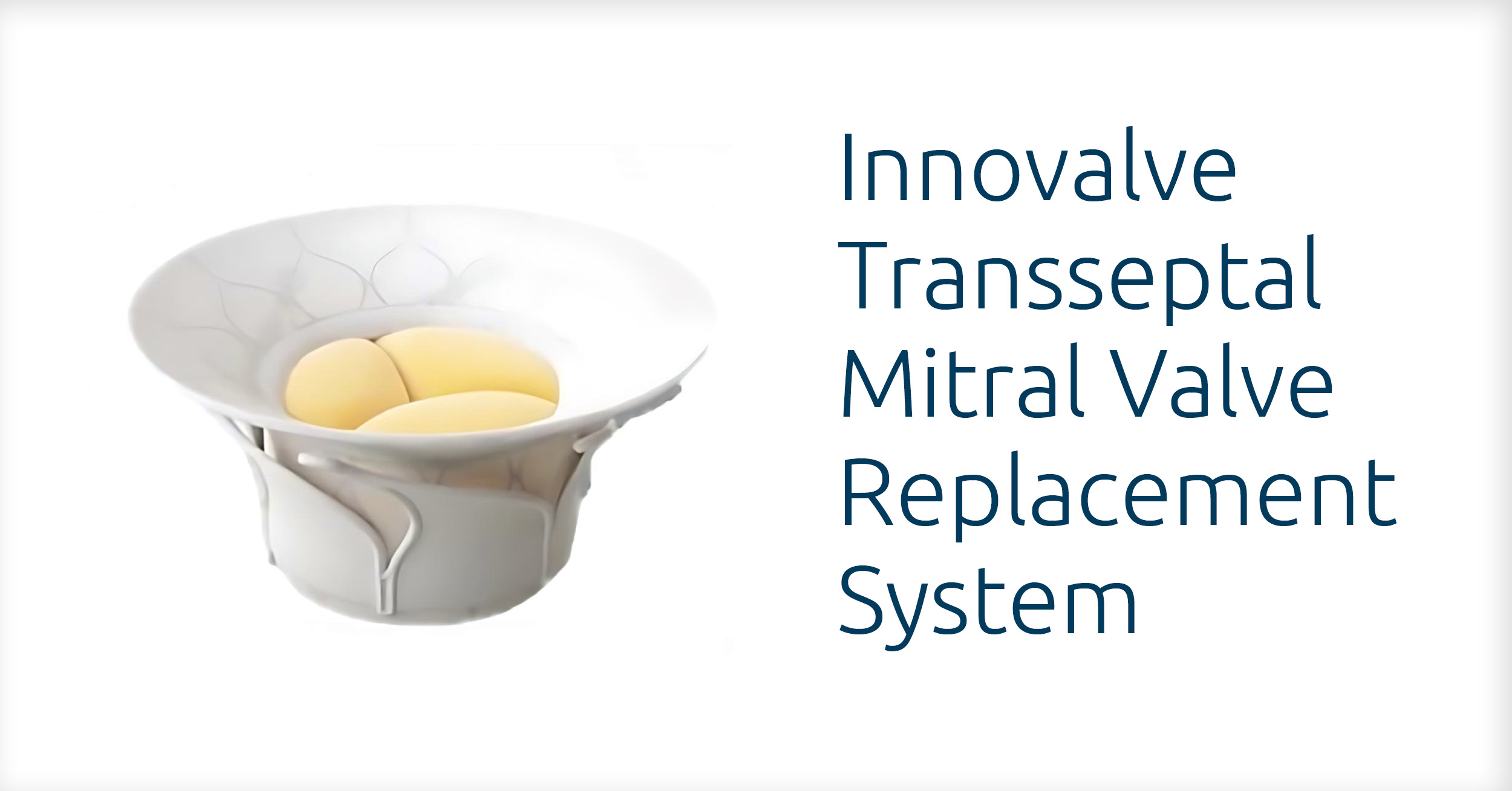 Aurora St. Luke’s Medical Center one of just five sites nationwide to study new investigational replacement heart valve system