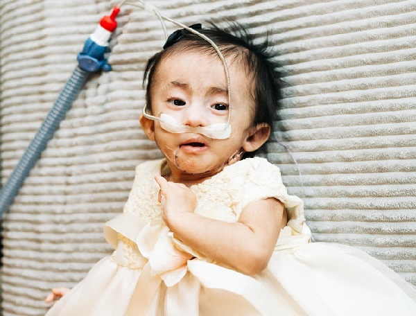 'She's always been our miracle baby'